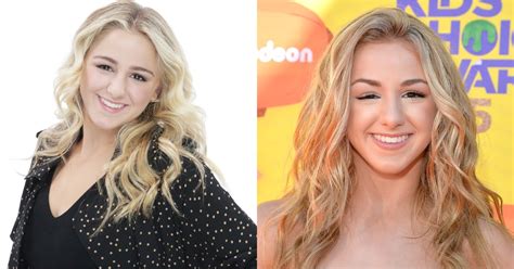 chloe lukasiak eye condition|chloe lukasiak eye problems.